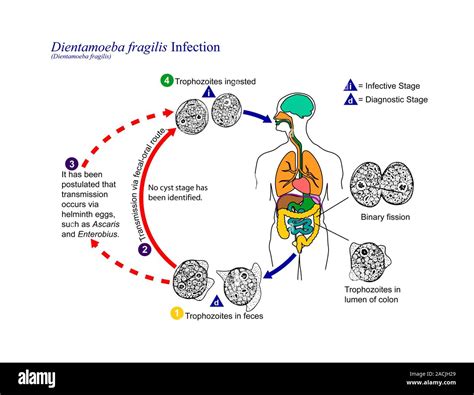  Dientamoeba Fragilis: Unmasking the Parasite Lurking in Our Guts!