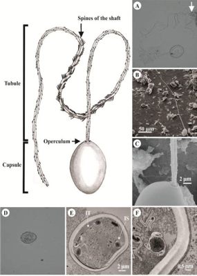  Karyorelict: Unraveling the Mystery of this Tiny but Mighty Mastigophore!